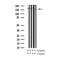 Invitrogen Phospho-ErbB2 (HER-2) (Tyr877) Polyclonal Antibody 100 &mu;L;