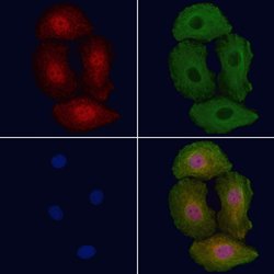 Invitrogen Phospho-ErbB2 (HER-2) (Tyr1112) Polyclonal Antibody 100 &mu;L;