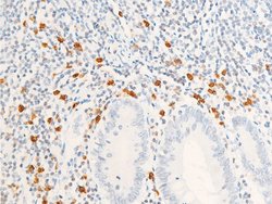 Invitrogen Phospho-ErbB2 (HER-2) (Tyr1112) Polyclonal Antibody 100 &mu;L;