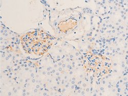 Invitrogen Phospho-ErbB2 (HER-2) (Tyr1112) Polyclonal Antibody 100 &mu;L;