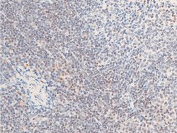 Invitrogen Phospho-ErbB2 (HER-2) (Tyr1112) Polyclonal Antibody 100 &mu;L;