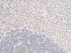 Invitrogen Phospho-ErbB2 (HER-2) (Tyr1112) Polyclonal Antibody 100 &mu;L;