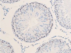 Invitrogen Phospho-ErbB2 (HER-2) (Tyr1112) Polyclonal Antibody 100 &mu;L;