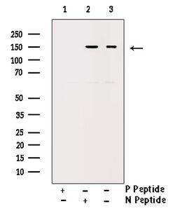 Invitrogen Phospho-ErbB2 (HER-2) (Tyr1112) Polyclonal Antibody 100 &mu;L;
