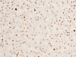 Invitrogen Phospho-TrkA (Tyr680, Tyr681) Polyclonal Antibody 100 &mu;L | Buy Online | Invitrogen&trade; | Fisher Scientific