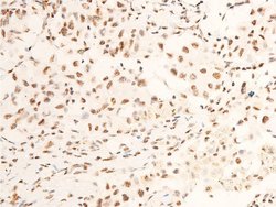 Invitrogen Phospho-TrkA (Tyr680, Tyr681) Polyclonal Antibody 100 &mu;L | Buy Online | Invitrogen&trade; | Fisher Scientific