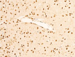 Invitrogen Phospho-TrkA (Tyr680, Tyr681) Polyclonal Antibody 100 &mu;L | Buy Online | Invitrogen&trade; | Fisher Scientific