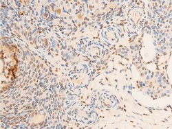 Invitrogen Phospho-TrkA (Tyr680, Tyr681) Polyclonal Antibody 100 &mu;L | Buy Online | Invitrogen&trade; | Fisher Scientific