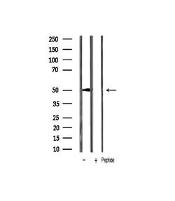 Invitrogen Phospho-p53 (Ser20) Polyclonal Antibody 100 &mu;L | Buy Online | Invitrogen&trade; | Fisher Scientific