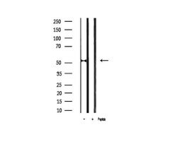 Invitrogen Phospho-p53 (Ser20) Polyclonal Antibody 100 &mu;L | Buy Online | Invitrogen&trade; | Fisher Scientific
