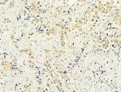 Invitrogen Phospho-p53 (Ser15) Polyclonal Antibody 100 &mu;L; Unconjugated:Antibodies,
