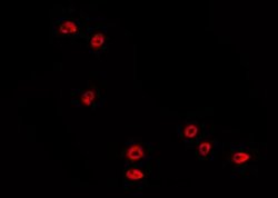 Invitrogen Phospho-p53 (Ser15) Polyclonal Antibody 100 &mu;L; Unconjugated:Antibodies,