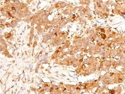 Invitrogen Phospho-p53 (Ser15) Polyclonal Antibody 100 &mu;L; Unconjugated:Antibodies,