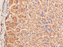 Invitrogen Phospho-p53 (Ser15) Polyclonal Antibody 100 &mu;L; Unconjugated:Antibodies,