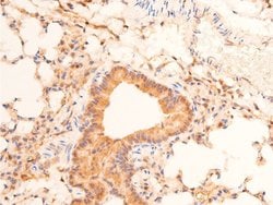 Invitrogen Phospho-p53 (Ser15) Polyclonal Antibody 100 &mu;L; Unconjugated:Antibodies,