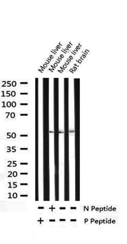 Invitrogen Phospho-p53 (Ser15) Polyclonal Antibody 100 &mu;L; Unconjugated:Antibodies,