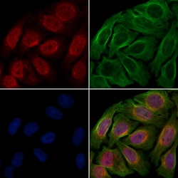Invitrogen Phospho-p53 (Ser46) Polyclonal Antibody 100 &mu;L; Unconjugated:Antibodies,