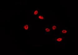 Invitrogen Phospho-p53 (Ser46) Polyclonal Antibody 100 &mu;L; Unconjugated:Antibodies,