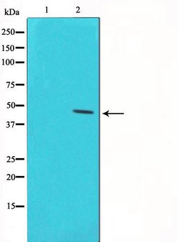 Invitrogen Phospho-p53 (Ser46) Polyclonal Antibody 100 &mu;L; Unconjugated:Antibodies,