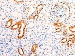 Invitrogen Phospho-c-Jun (Ser63) Polyclonal Antibody 100 &mu;L; Unconjugated:Antibodies,