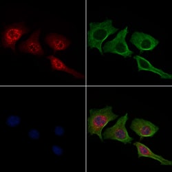 Invitrogen Phospho-c-Jun (Thr91) Polyclonal Antibody 100 &mu;L; Unconjugated:Antibodies,