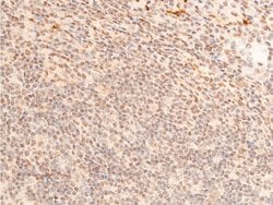 Invitrogen Phospho-c-Jun (Thr93) Polyclonal Antibody 100 &mu;L | Buy Online | Invitrogen&trade; | Fisher Scientific
