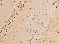 Invitrogen Phospho-c-Jun (Thr93) Polyclonal Antibody 100 &mu;L | Buy Online | Invitrogen&trade; | Fisher Scientific