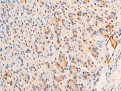 Invitrogen Phospho-c-Jun (Thr93) Polyclonal Antibody 100 &mu;L | Buy Online | Invitrogen&trade; | Fisher Scientific