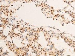 Invitrogen Phospho-c-Jun (Thr93) Polyclonal Antibody 100 &mu;L | Buy Online | Invitrogen&trade; | Fisher Scientific