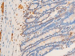 Invitrogen Phospho-c-Jun (Thr93) Polyclonal Antibody 100 &mu;L | Buy Online | Invitrogen&trade; | Fisher Scientific