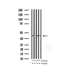 Invitrogen Phospho-c-Jun (Thr93) Polyclonal Antibody 100 &mu;L | Buy Online | Invitrogen&trade; | Fisher Scientific