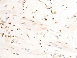 Invitrogen Phospho-c-Jun (Tyr170) Polyclonal Antibody 100 &mu;L; Unconjugated:Antibodies,