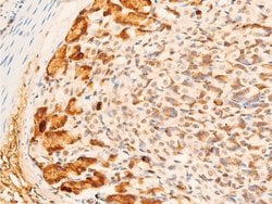 Invitrogen Phospho-c-Jun (Tyr170) Polyclonal Antibody 100 &mu;L; Unconjugated:Antibodies,