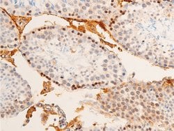 Invitrogen Phospho-c-Jun (Tyr170) Polyclonal Antibody 100 &mu;L; Unconjugated:Antibodies,