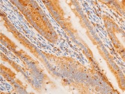 Invitrogen Phospho-c-Jun (Tyr170) Polyclonal Antibody 100 &mu;L; Unconjugated:Antibodies,