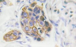 Invitrogen Phospho-INSR (Tyr1361) Polyclonal Antibody 100 &mu;L; Unconjugated:Antibodies,