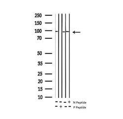 Invitrogen Phospho-INSR (Tyr1361) Polyclonal Antibody 100 &mu;L; Unconjugated:Antibodies,