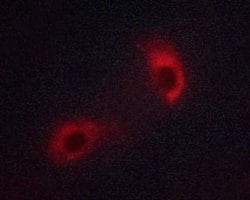 Invitrogen Phospho-LCK (Tyr394) Polyclonal Antibody 100 &mu;L; Unconjugated:Antibodies,