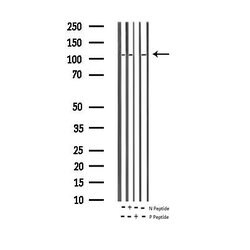 Invitrogen Phospho-Rb (Ser795) Polyclonal Antibody 100 &mu;L; Unconjugated:Antibodies,