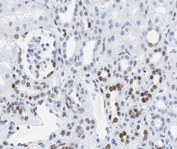 Invitrogen Phospho-Rb (Ser807) Polyclonal Antibody 100 &mu;L; Unconjugated:Antibodies,