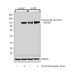 Invitrogen Phospho-Rb (Ser807) Polyclonal Antibody 100 &mu;L; Unconjugated:Antibodies,