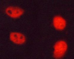 Invitrogen Phospho-NPM1 (Thr199) Polyclonal Antibody 100 &mu;L | Buy Online | Invitrogen&trade; | Fisher Scientific