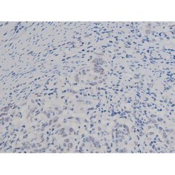 Invitrogen Phospho-NPM1 (Thr199) Polyclonal Antibody 100 &mu;L | Buy Online | Invitrogen&trade; | Fisher Scientific
