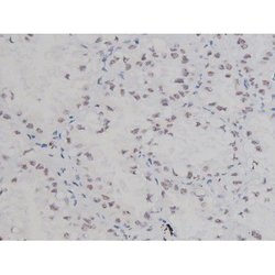 Invitrogen Phospho-NPM1 (Thr199) Polyclonal Antibody 100 &mu;L | Buy Online | Invitrogen&trade; | Fisher Scientific