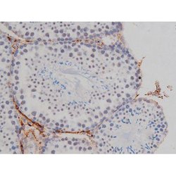 Invitrogen Phospho-NPM1 (Thr199) Polyclonal Antibody 100 &mu;L | Buy Online | Invitrogen&trade; | Fisher Scientific