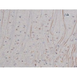 Invitrogen Phospho-NPM1 (Thr199) Polyclonal Antibody 100 &mu;L | Buy Online | Invitrogen&trade; | Fisher Scientific