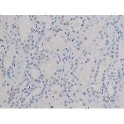 Invitrogen Phospho-NPM1 (Thr199) Polyclonal Antibody 100 &mu;L | Buy Online | Invitrogen&trade; | Fisher Scientific