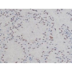 Invitrogen Phospho-NPM1 (Thr199) Polyclonal Antibody 100 &mu;L | Buy Online | Invitrogen&trade; | Fisher Scientific