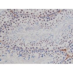 Invitrogen Phospho-NPM1 (Thr199) Polyclonal Antibody 100 &mu;L | Buy Online | Invitrogen&trade; | Fisher Scientific