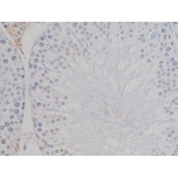 Invitrogen Phospho-NPM1 (Thr199) Polyclonal Antibody 100 &mu;L | Buy Online | Invitrogen&trade; | Fisher Scientific